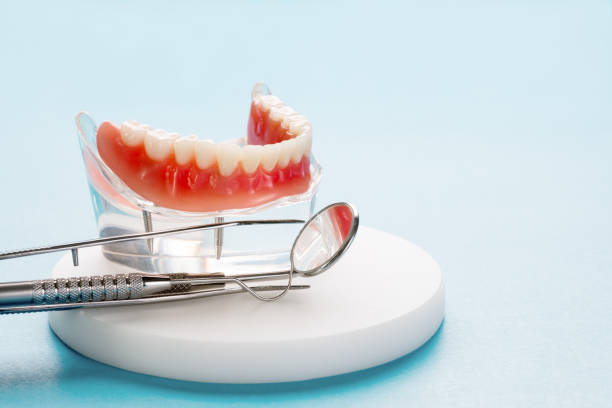 Dental Bonding in Security Widefield, CO